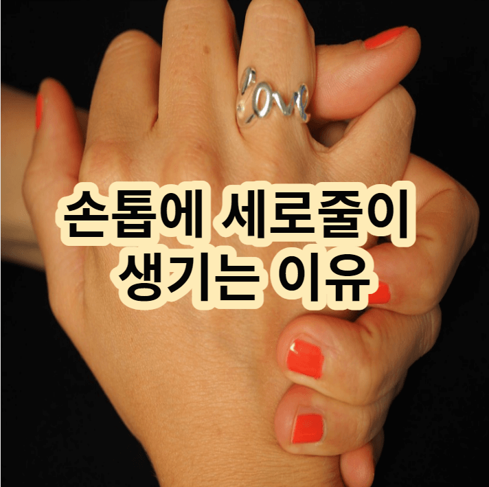 손톱에 세로줄이 생기는이유